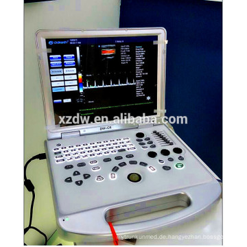 Beweglicher Ultraschall / USG / Medizinische Sonographie